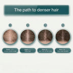 BioDensity+ | Hair Microinfusion System