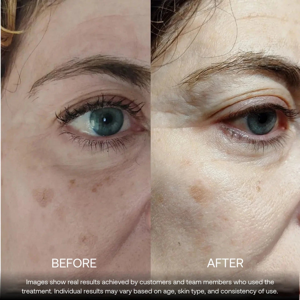 Before and after — Bioceutica customer