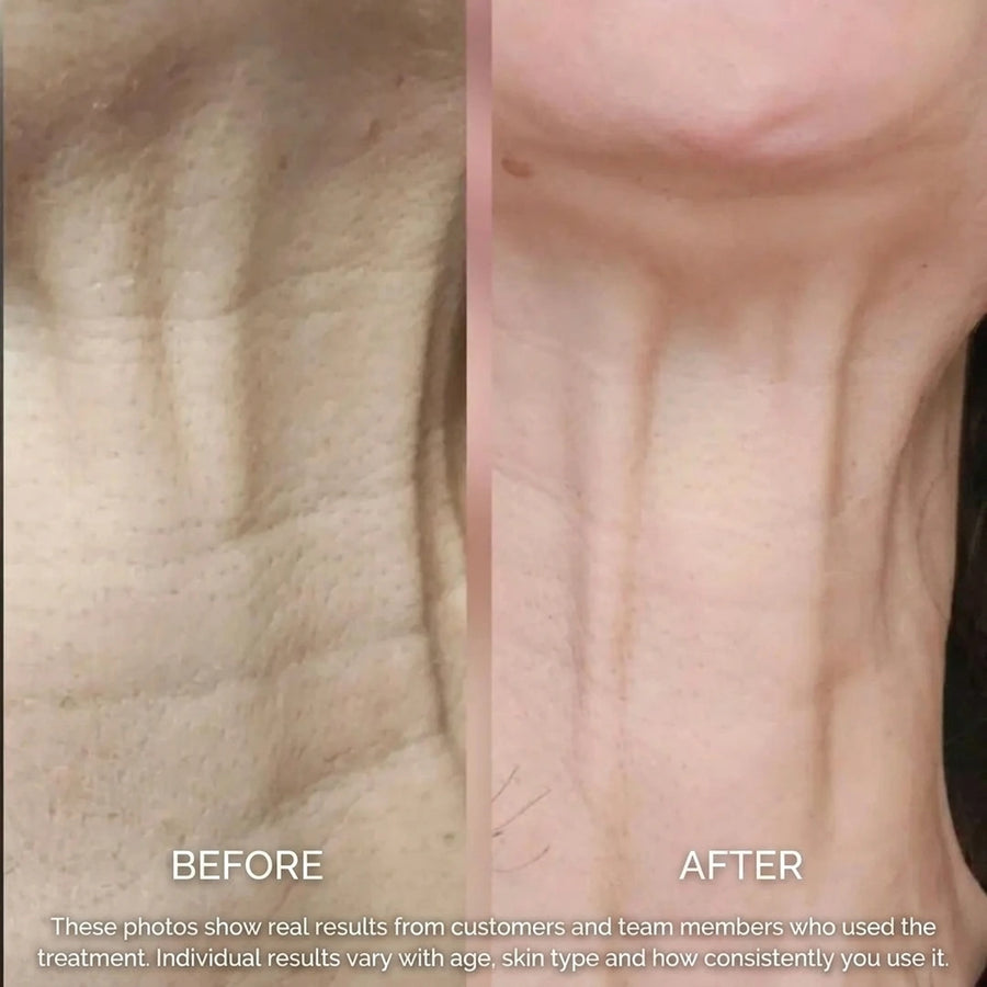 Customer result