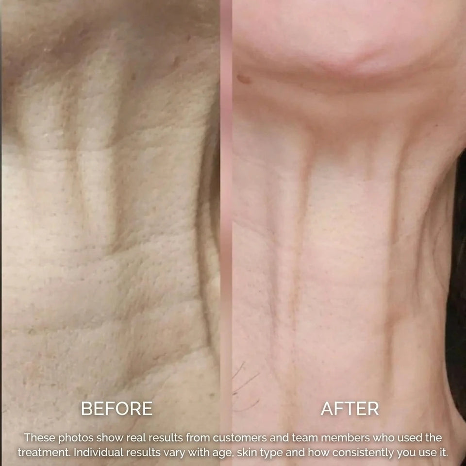 Before and after — Bioceutica customer