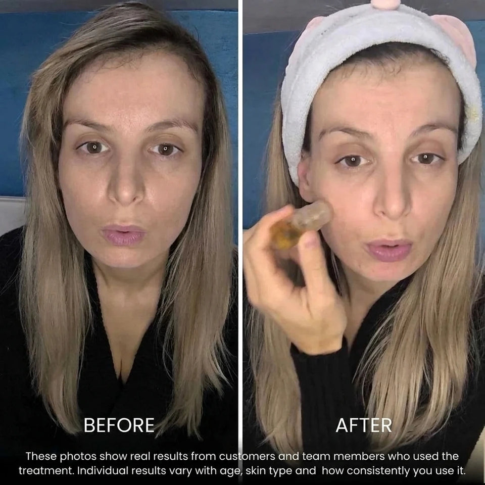 Before and after — Bioceutica customer