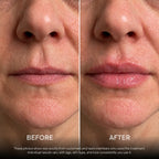 Before and after lips — 3 applications